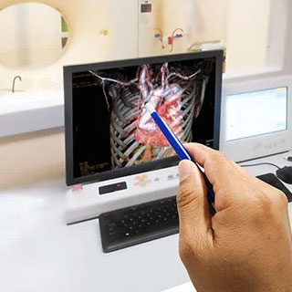 Coronary Angiography & Angioplasty